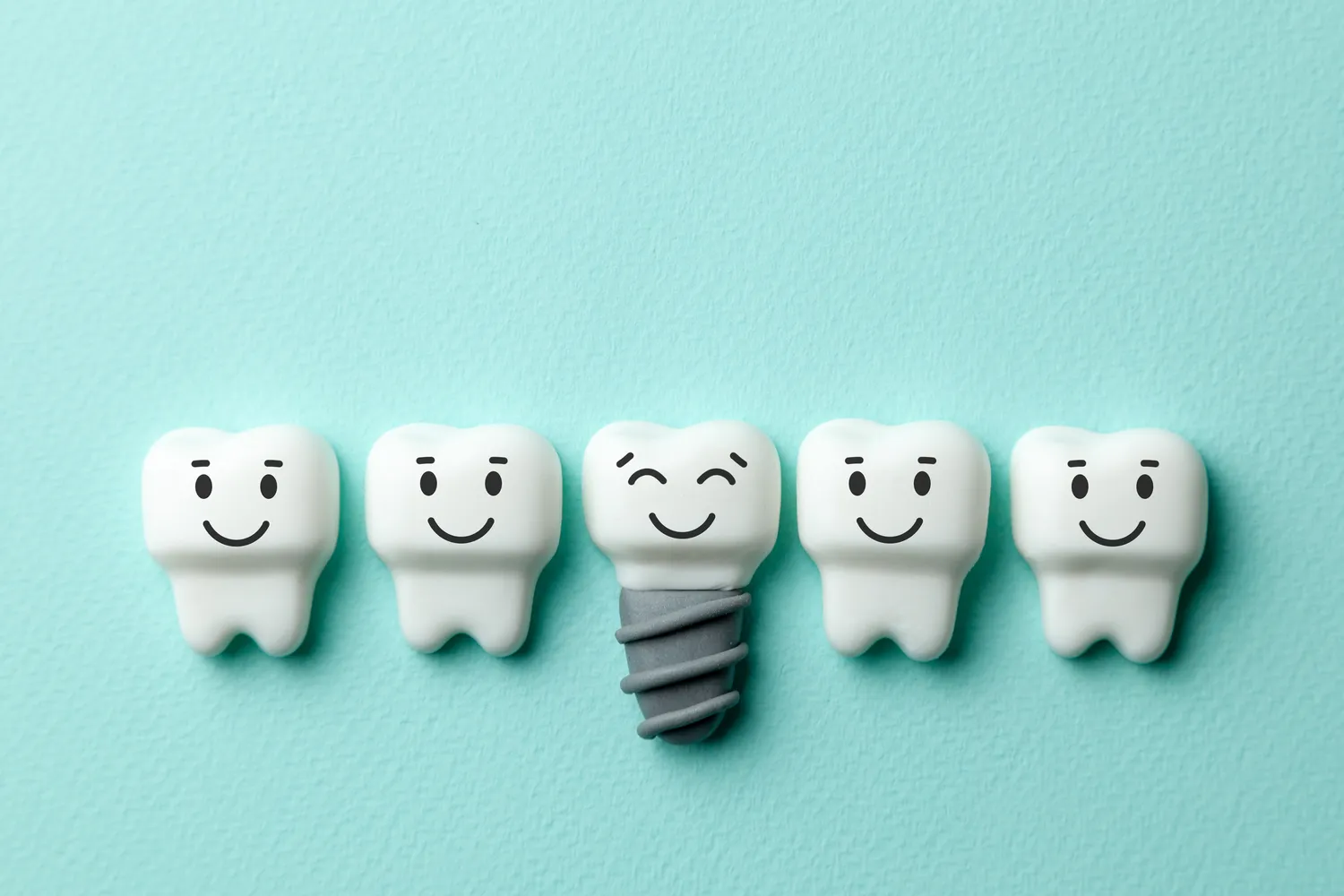 Dlaczego warto wybrać implanty?