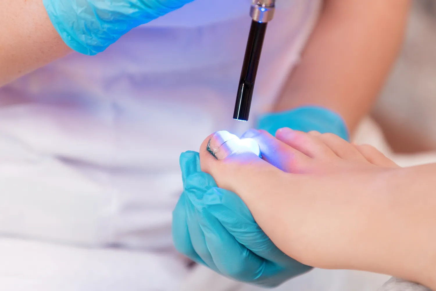 Czym jest pedicure leczniczy oraz na czym dokładnie polega?