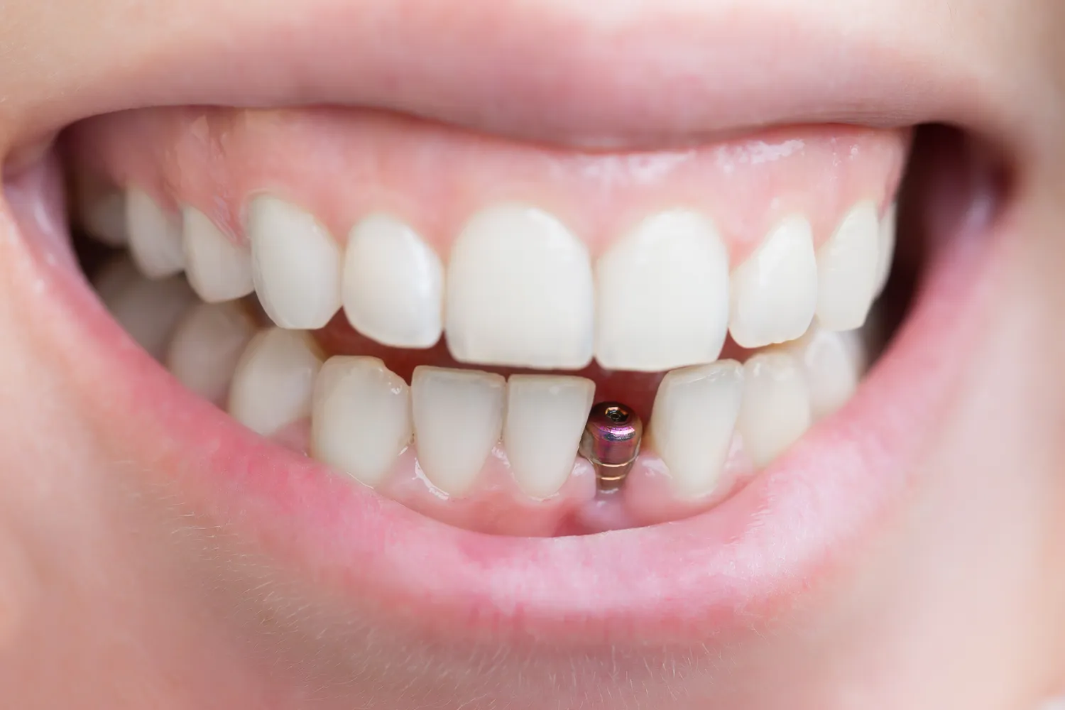 Dentysta dziecięcy Szczecin